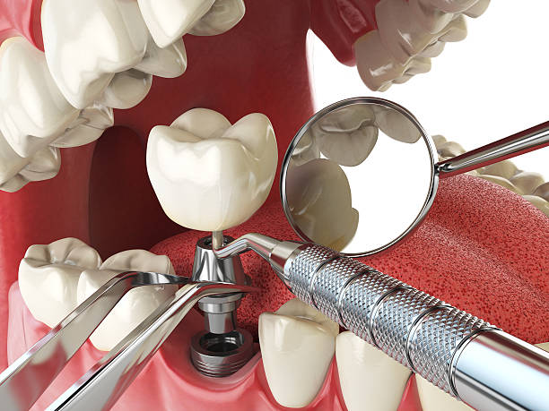 Best Urgent Care for Lost Fillings or Crowns in Midland Park, NJ